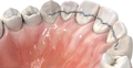 prime4me® RETAIN3R maxilla