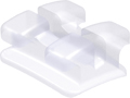 discovery® pearl, ceramic bracket, tooth 21, +17° torque, +4° angulation, McLaughlin-Bennett-Trevisi** 22